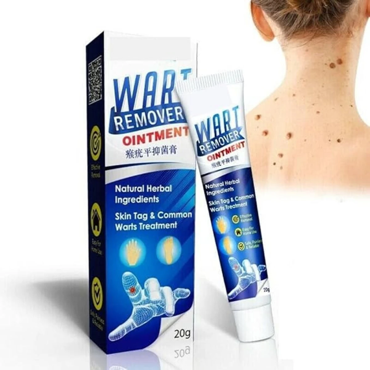 Wart Skin Tag Removal Ointment