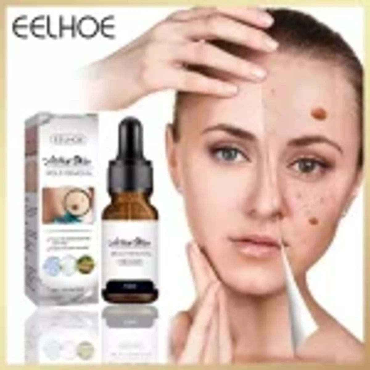 EELHOE Aclive Skin Mole Removal Oil 10 ML